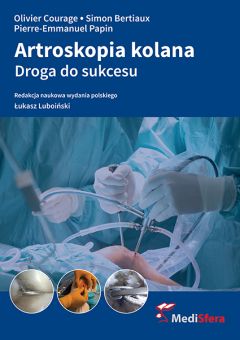 Artroskopia kolana. Droga do sukcesu